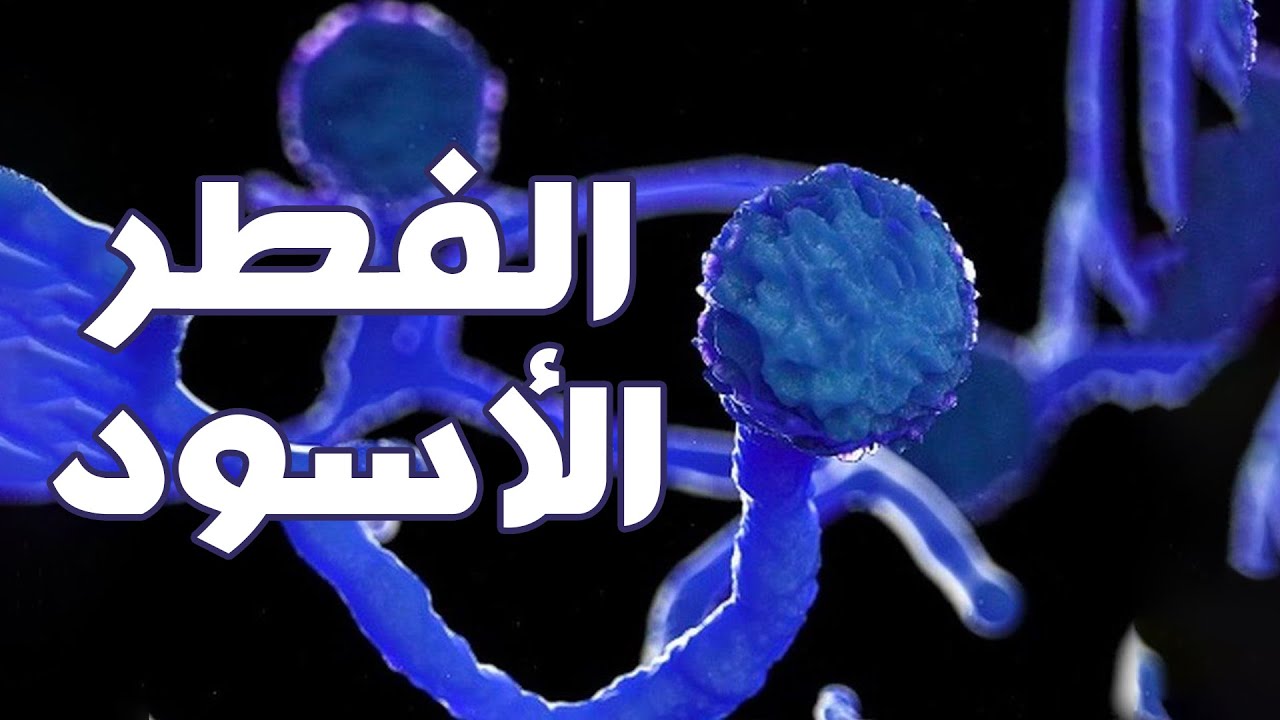 الفطر الأسود