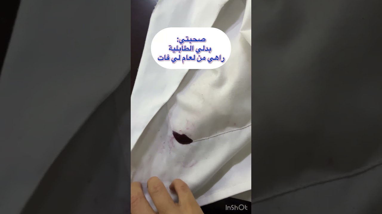 حالة المئزر بعد اسبوع عمل #أستاذة